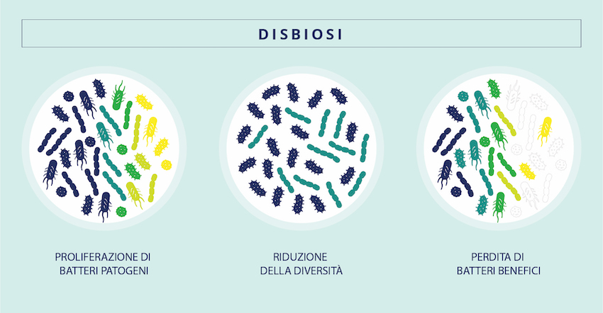 I diversi tipi di squilibrio del microbiota portano alla disbiosi.